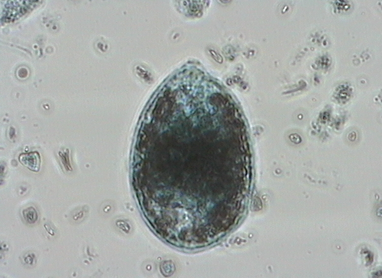 Dictyocha speculum
